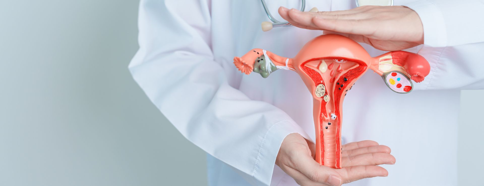 Endometriosis care and how to advocate for yourself
