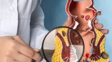 Diagram of a colonoscopy.