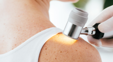 Dermatology patient